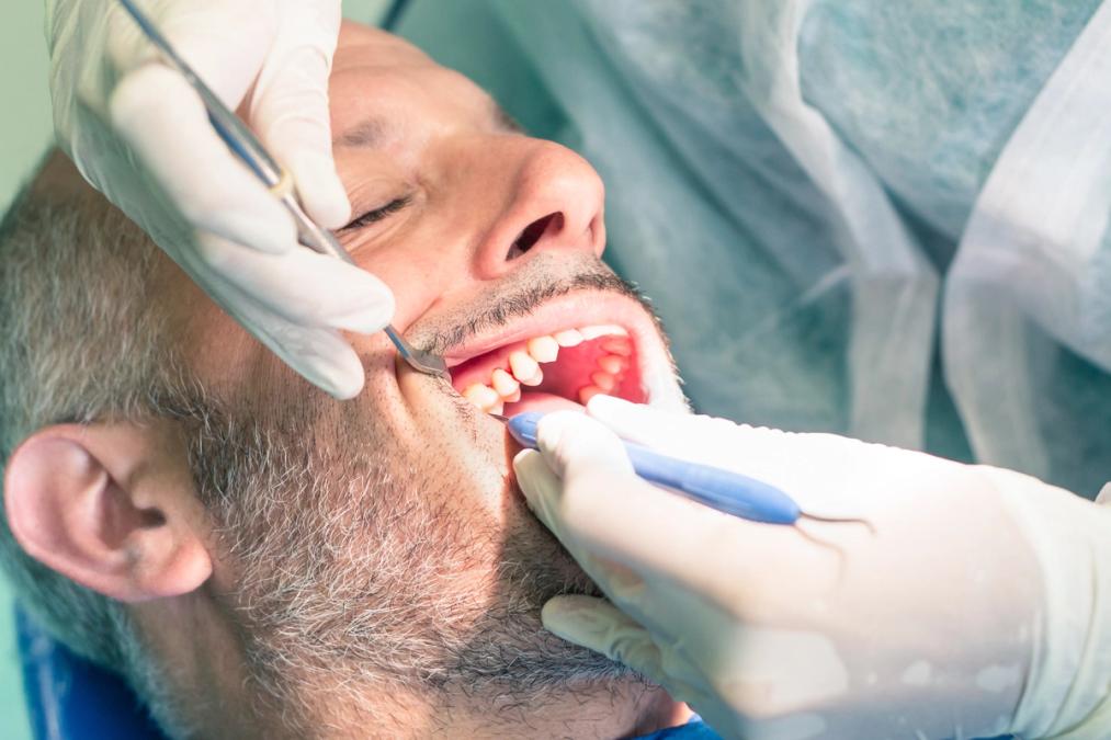 Lake Houston Endodontics | Root Canals