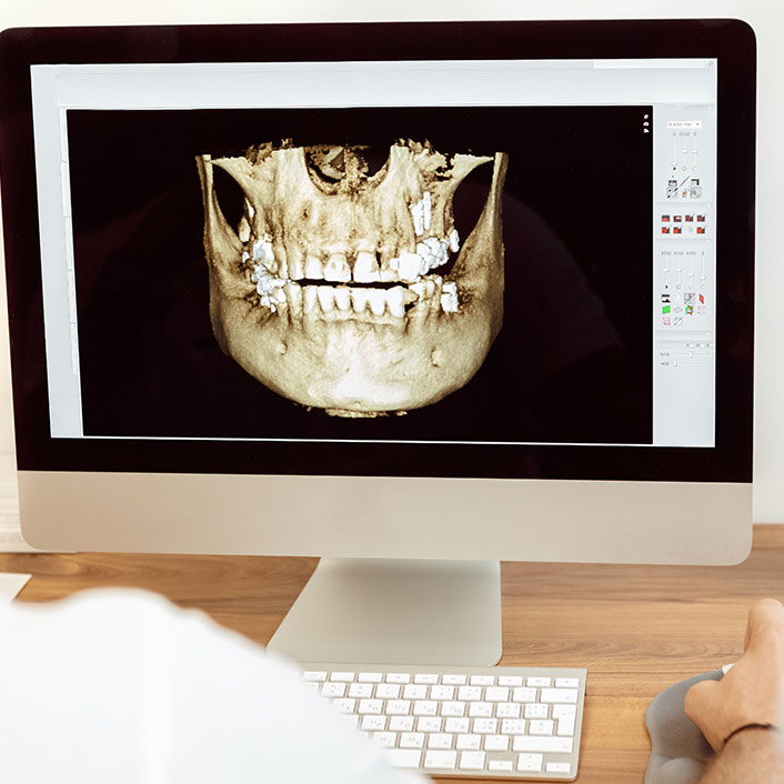 Lake Houston Endodontics | Dental Technologies
