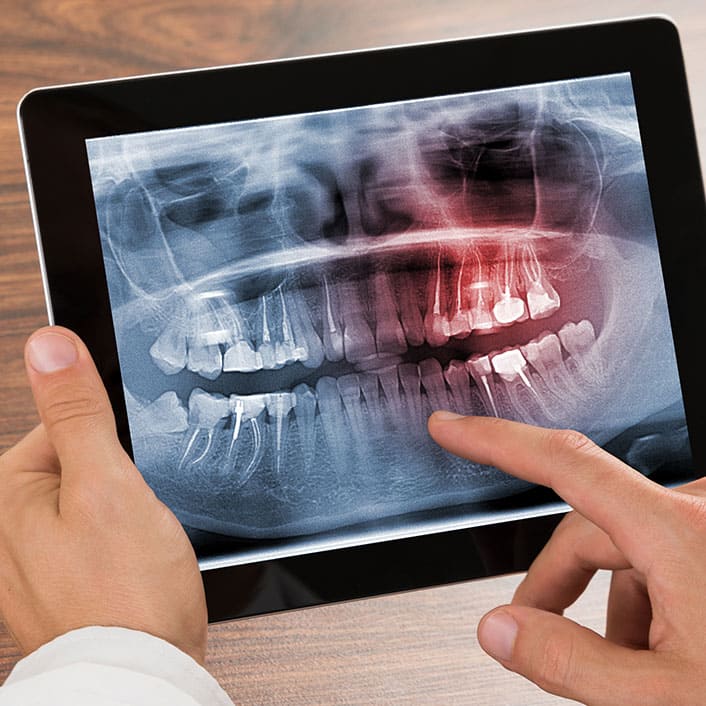 Lake Houston Endodontics | Dental Technologies